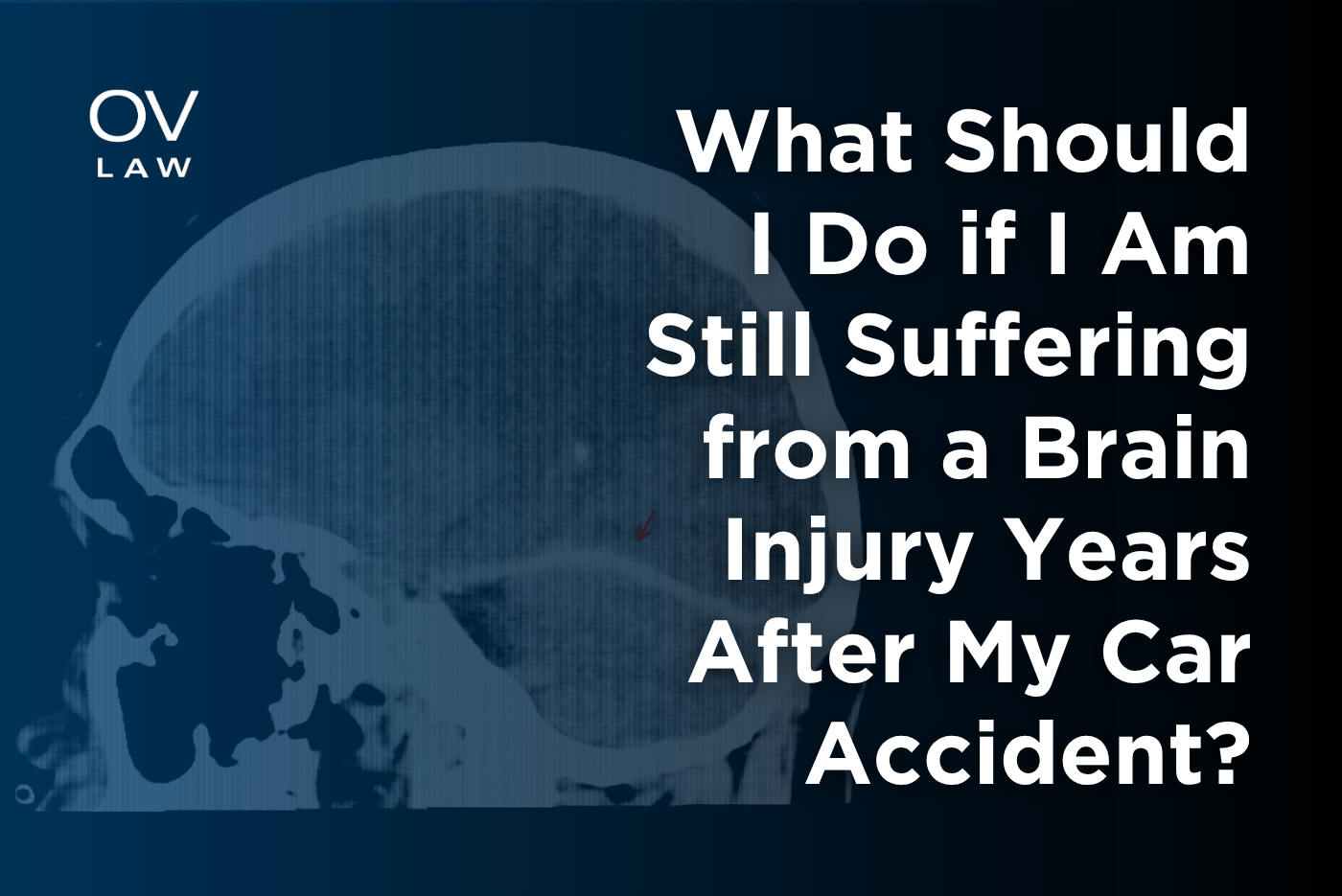 What Should I Do if I Am Still Suffering from a Brain Injury Years After My Car Accident?