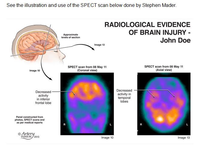 radiological evidence